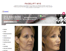 Tablet Screenshot of faceliftnyc.net